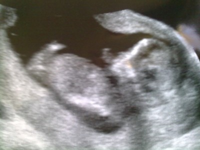01032010086.jpg